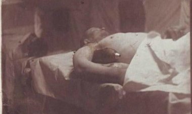 Хирург и сапёр в одном лице